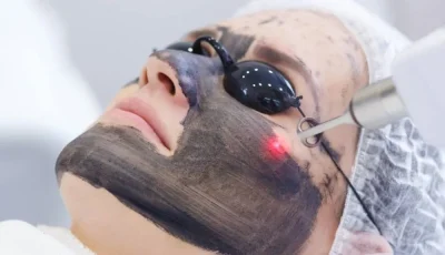 فوائد غير معروفة للليزر الكربوني للوجه
