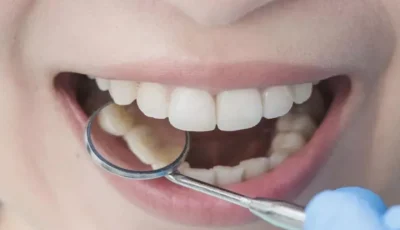 تدهور صحة الأسنان مرتبط بالأمراض المزمنة