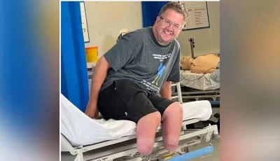 جراح يقصد بتر ساقيه من أجل الاحتيال على شركة التأمين